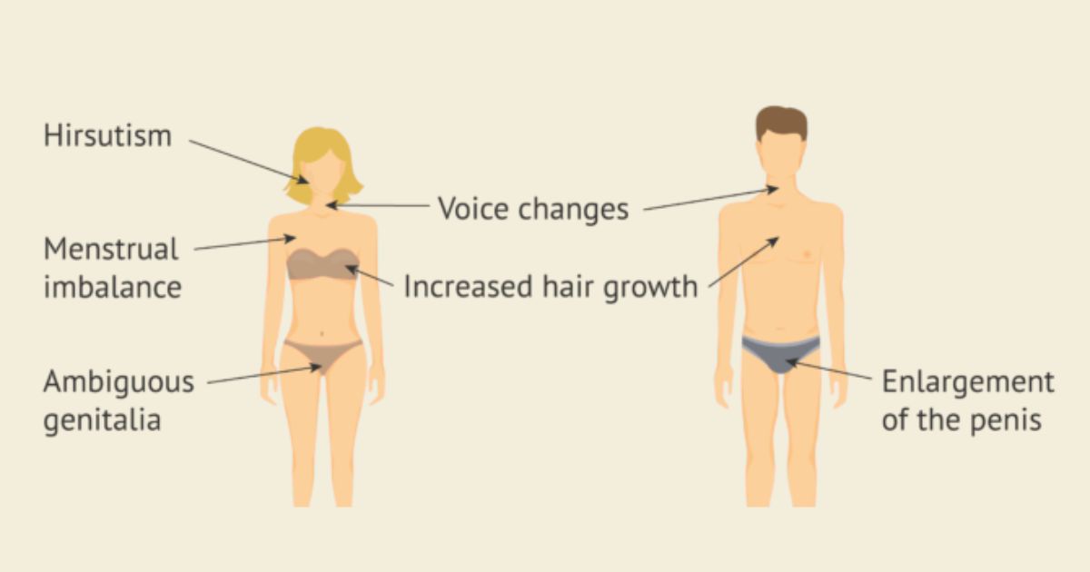 Understanding CAH in Women: 7 Must-Know Insights on Health & Treatment